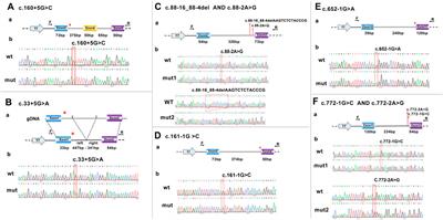 Molecular analysis of eight splicing variants in the hydroxymethylbilane synthase gene